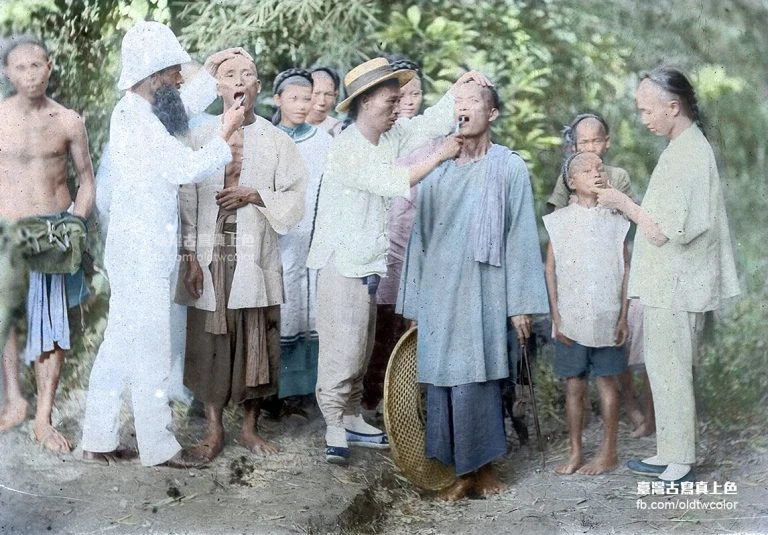 馬偕博士為臺灣人拔牙照片數位上色